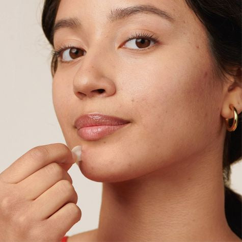 PARCHE PARA ACNE